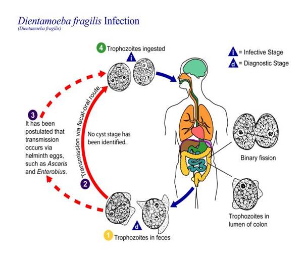 Intestinal protozoan infections (parasitic diarrhea)
